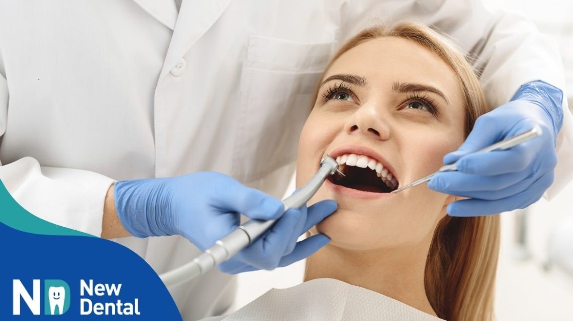 Quando fare la pulizia dei denti
